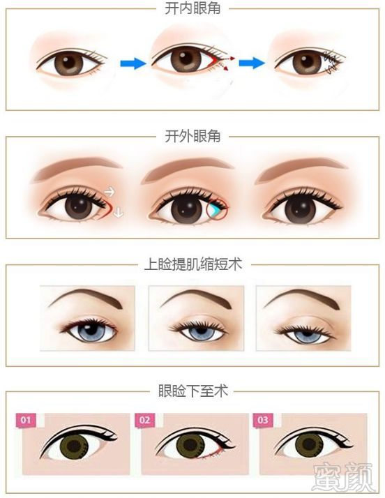 https://img.miyanlife.com/mnt/timg/180408/11563H415-4.jpg