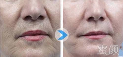 https://img.miyanlife.com/mnt/timg/180408/115R91949-12.jpg