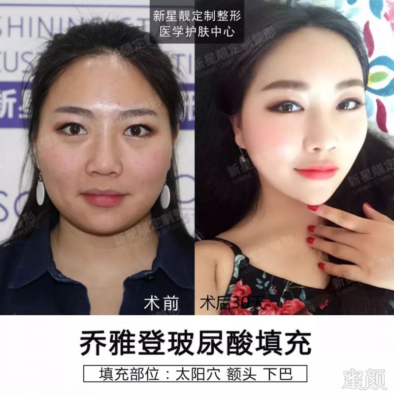 https://img.miyanlife.com/mnt/timg/180408/121A35U9-3.jpg