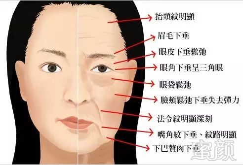 https://img.miyanlife.com/mnt/timg/180408/1223024121-3.jpg