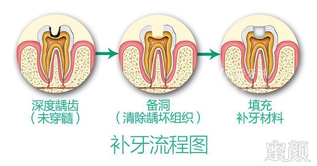 案例图片