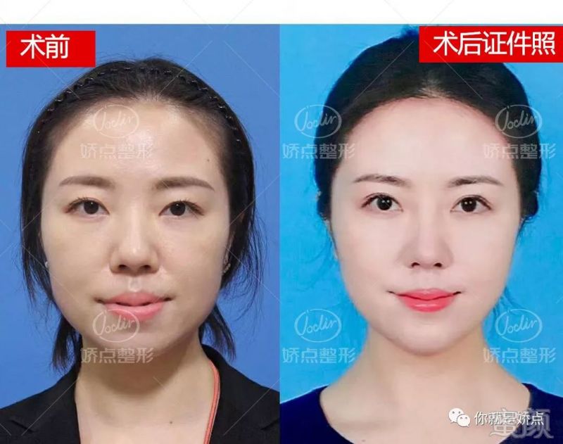 https://img.miyanlife.com/mnt/timg/180408/12251160A-7.jpg