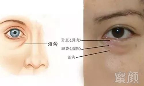 https://img.miyanlife.com/mnt/timg/180408/122JT322-4.jpg