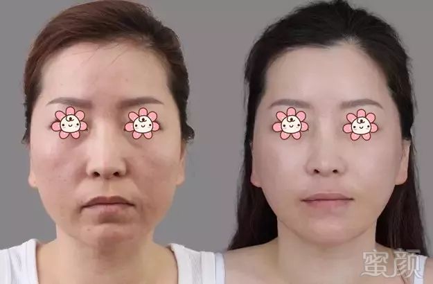 https://img.miyanlife.com/mnt/timg/180408/122K42R8-11.jpg