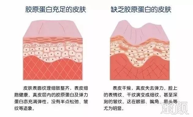 https://img.miyanlife.com/mnt/timg/180408/122K4F51-9.jpg