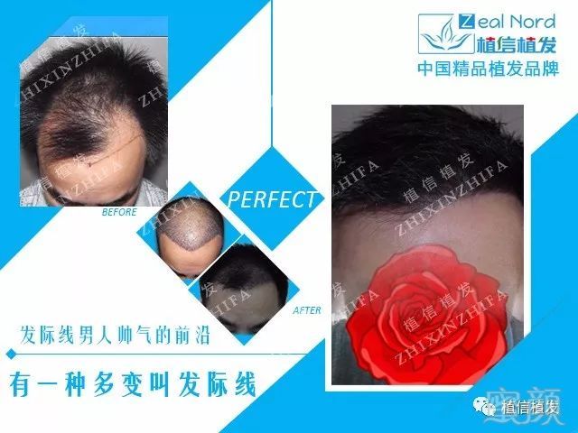 https://img.miyanlife.com/mnt/timg/180409/102H93352-5.jpg