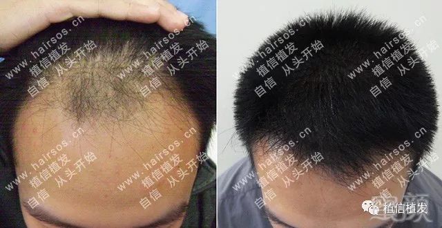 https://img.miyanlife.com/mnt/timg/180409/102HH001-0.jpg