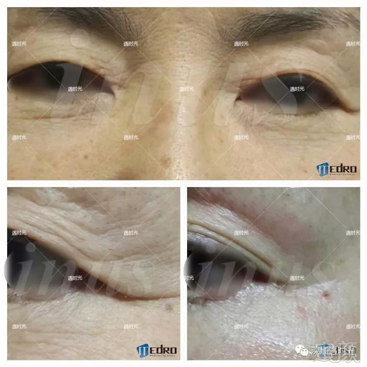 https://img.miyanlife.com/mnt/timg/180409/1033132593-12.jpg