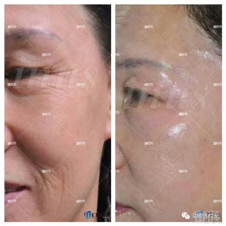 https://img.miyanlife.com/mnt/timg/180409/1033133294-13.jpg