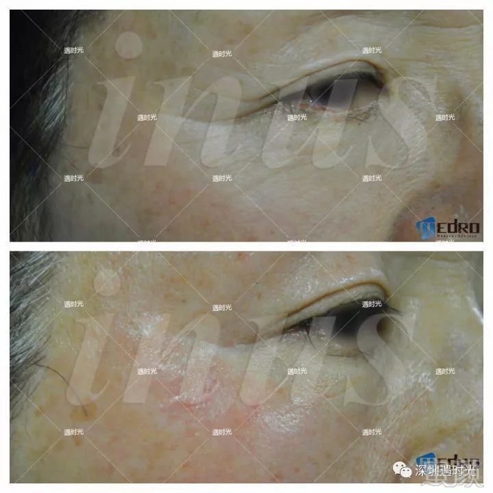 https://img.miyanlife.com/mnt/timg/180409/103313H25-11.jpg