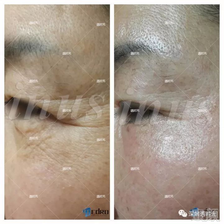 https://img.miyanlife.com/mnt/timg/180409/1033143H6-14.jpg