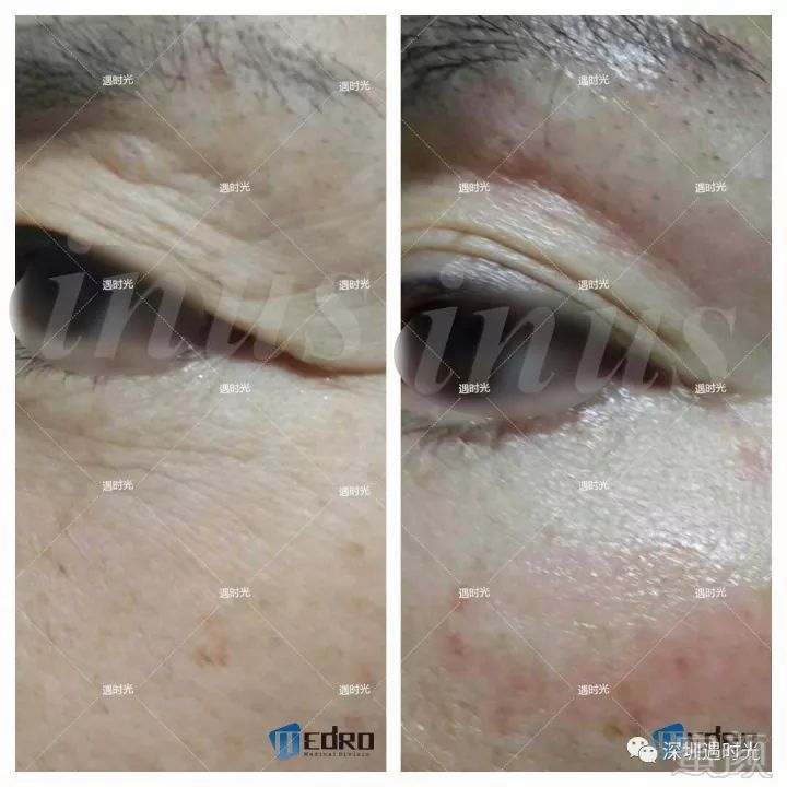 https://img.miyanlife.com/mnt/timg/180409/1033143Z7-15.jpg
