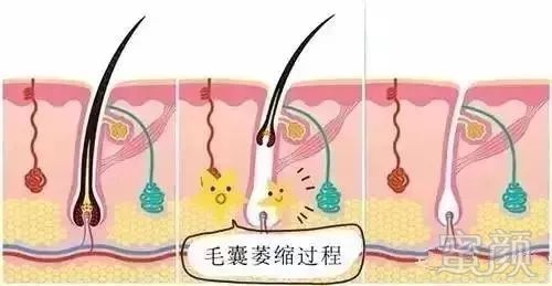 https://img.miyanlife.com/mnt/timg/180409/11060U938-5.jpg