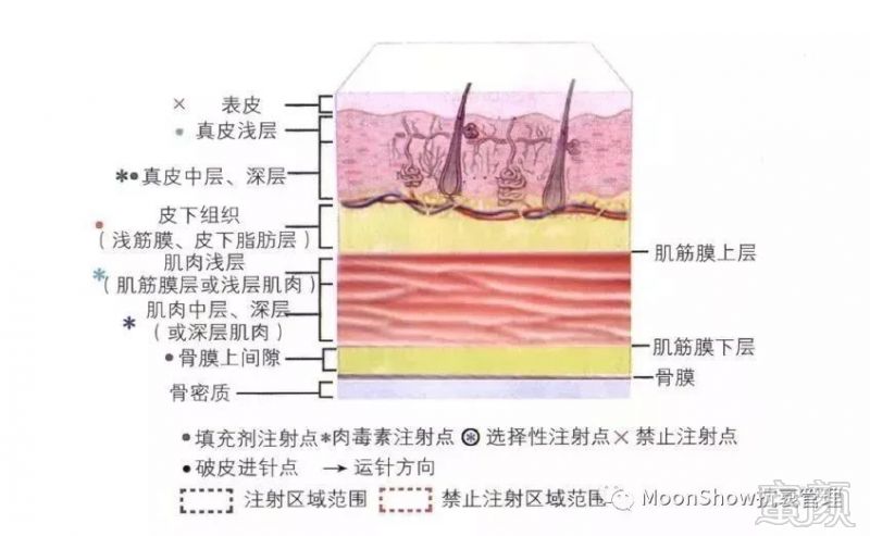 https://img.miyanlife.com/mnt/timg/180409/11162312O-7.jpg