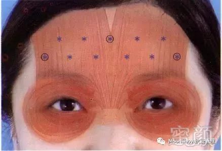 https://img.miyanlife.com/mnt/timg/180409/11162342Y-8.jpg