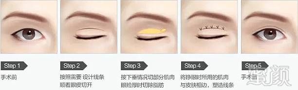 https://img.miyanlife.com/mnt/timg/180409/11351a493-6.jpg