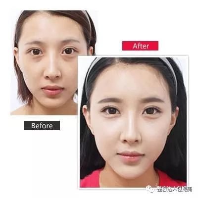 https://img.miyanlife.com/mnt/timg/180409/1143332002-1.jpg