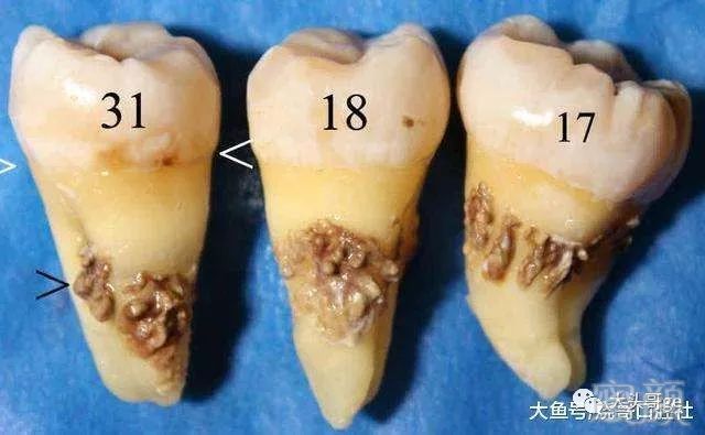 案例图片