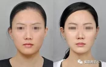 https://img.miyanlife.com/mnt/timg/180409/121153N38-1.jpg