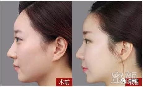 https://img.miyanlife.com/mnt/timg/180410/11332BT5-3.jpg