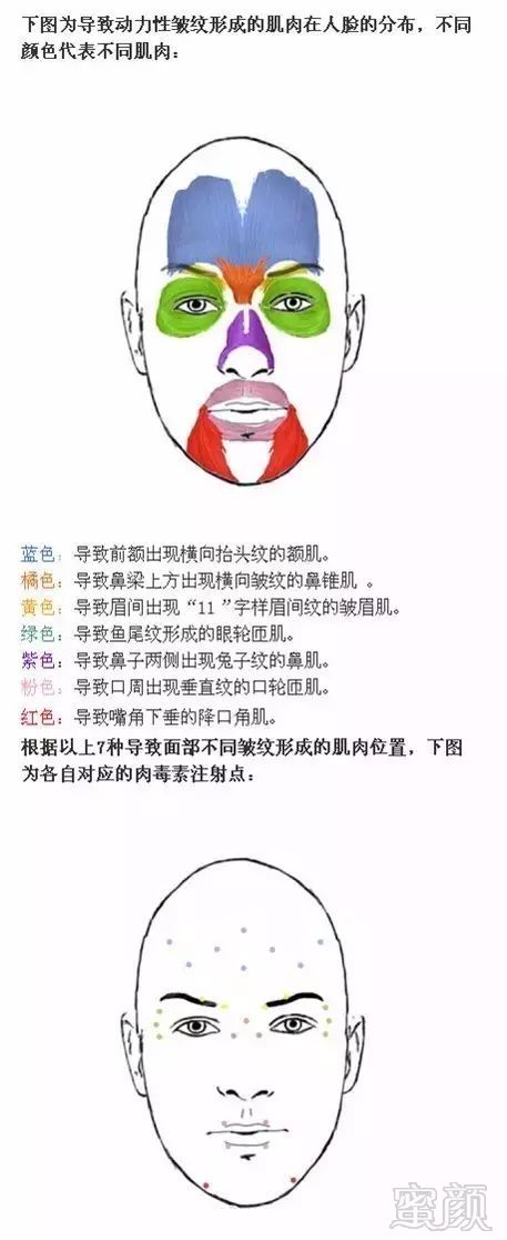 https://img.miyanlife.com/mnt/timg/180410/120J35c3-0.jpg