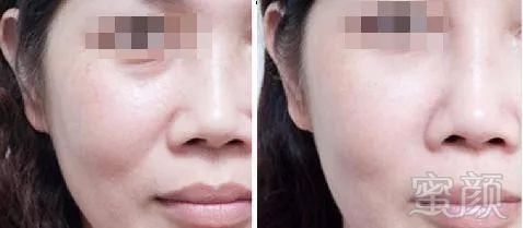https://img.miyanlife.com/mnt/timg/180410/1210441235-4.jpg