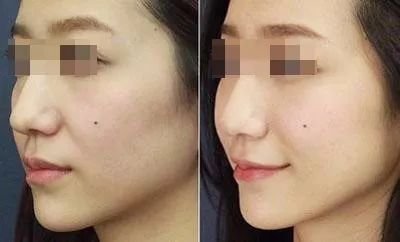 https://img.miyanlife.com/mnt/timg/180410/12104424N-3.jpg