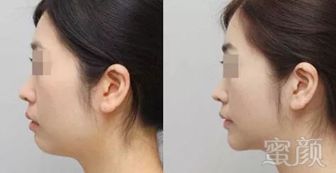 https://img.miyanlife.com/mnt/timg/180410/12104459E-2.jpg