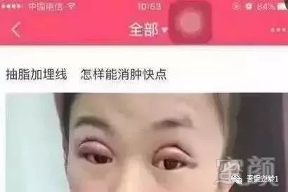 https://img.miyanlife.com/mnt/timg/180410/12115Vb6-1.jpg