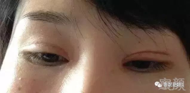 https://img.miyanlife.com/mnt/timg/180410/1212001961-5.jpg