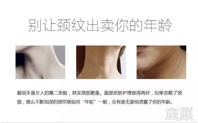 https://img.miyanlife.com/mnt/timg/180410/121GB229-6.jpg