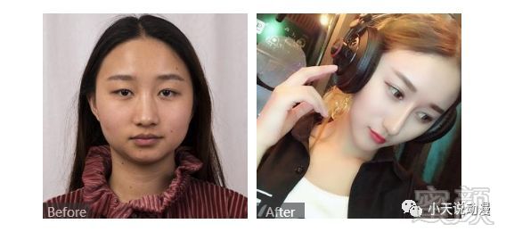 https://img.miyanlife.com/mnt/timg/180410/12454514Y-4.jpg