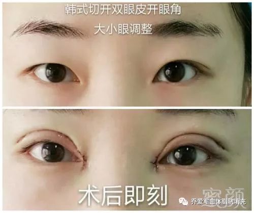 https://img.miyanlife.com/mnt/timg/180410/124Z93532-1.jpg