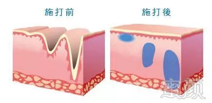 https://img.miyanlife.com/mnt/timg/180410/13015A157-3.jpg
