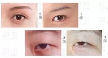 https://img.miyanlife.com/mnt/timg/180410/1330313450-6.jpg