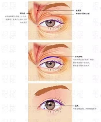 https://img.miyanlife.com/mnt/timg/180410/1330315622-8.jpg