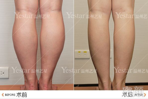 https://img.miyanlife.com/mnt/timg/180411/11235M514-3.jpg