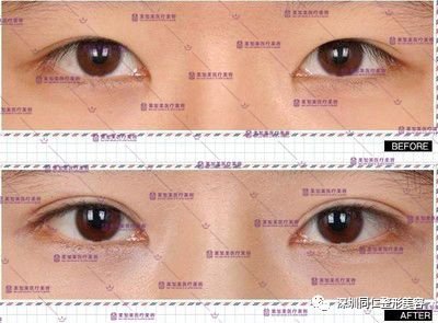 https://img.miyanlife.com/mnt/timg/180411/1213553Q8-4.jpg