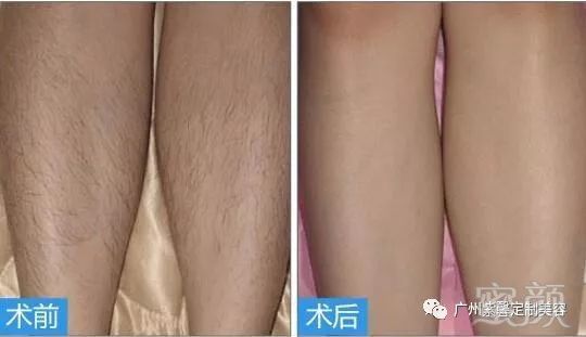 https://img.miyanlife.com/mnt/timg/180411/122F23442-6.jpg