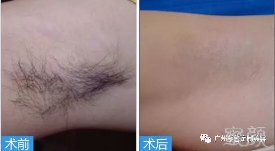 https://img.miyanlife.com/mnt/timg/180411/122F2N54-7.jpg