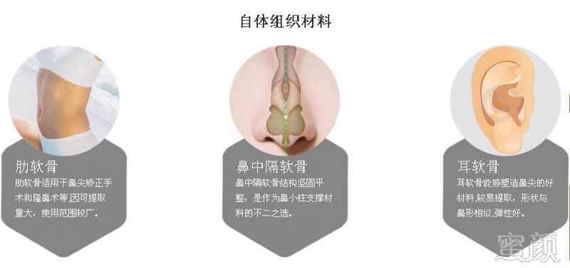 https://img.miyanlife.com/mnt/timg/180411/1231402419-8.jpg
