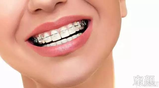 https://img.miyanlife.com/mnt/timg/180411/123P45O5-2.jpg