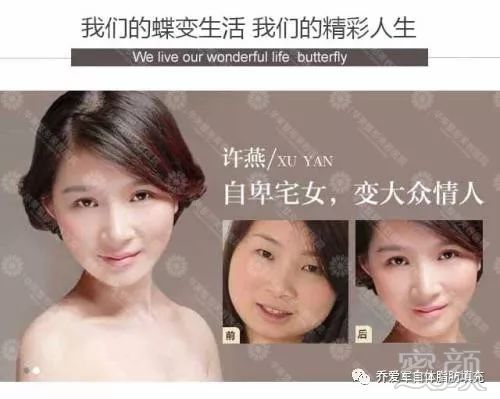 https://img.miyanlife.com/mnt/timg/180411/1241134c3-3.jpg