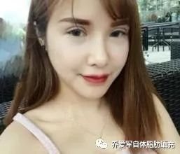 https://img.miyanlife.com/mnt/timg/180411/124113E37-2.jpg