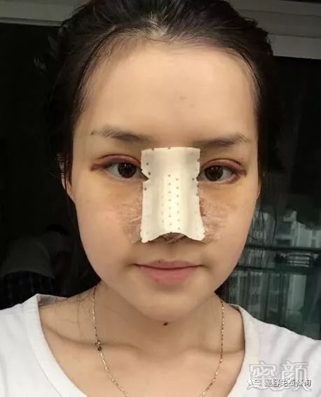 https://img.miyanlife.com/mnt/timg/180411/1243251632-1.jpg