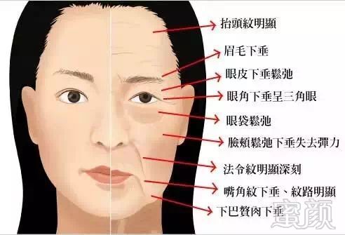 https://img.miyanlife.com/mnt/timg/180411/13111334G-0.jpg
