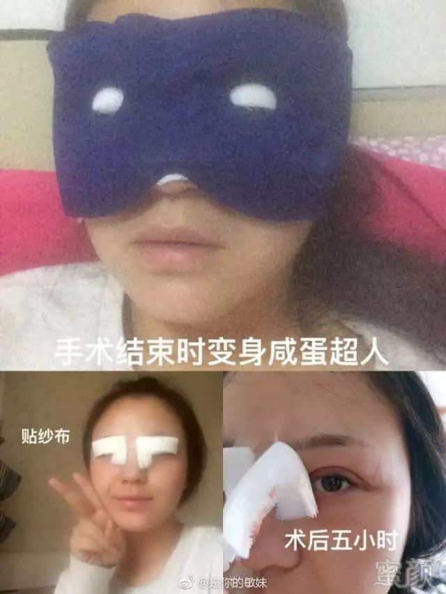 https://img.miyanlife.com/mnt/timg/180411/1315441943-3.jpg