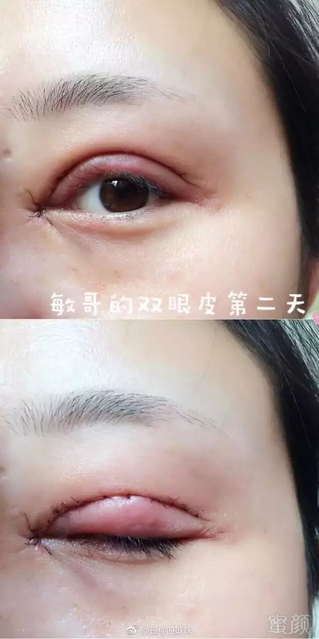 https://img.miyanlife.com/mnt/timg/180411/1315444C3-4.jpg