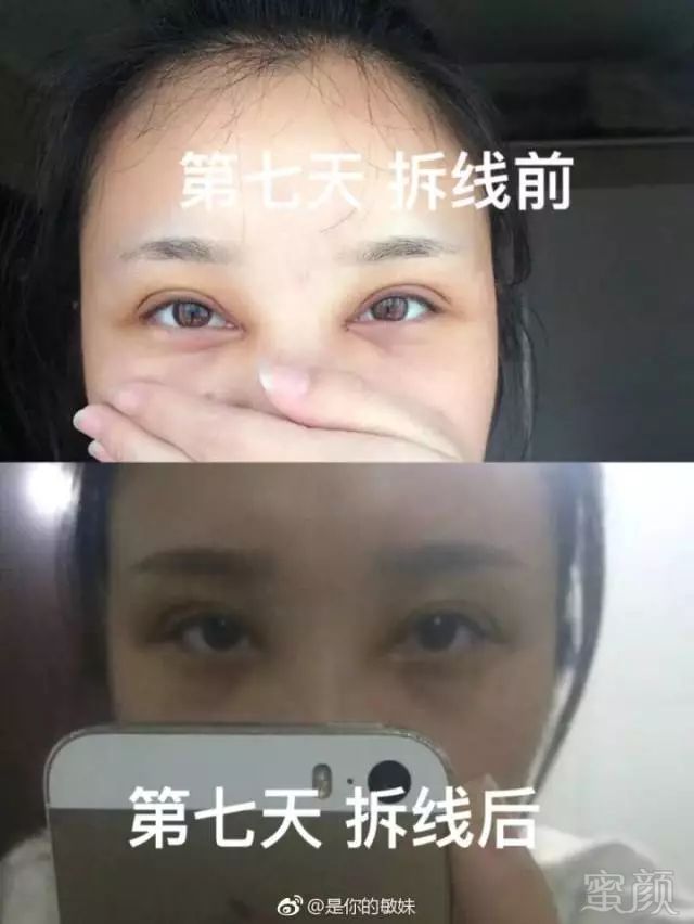 https://img.miyanlife.com/mnt/timg/180411/13154B4B-5.jpg