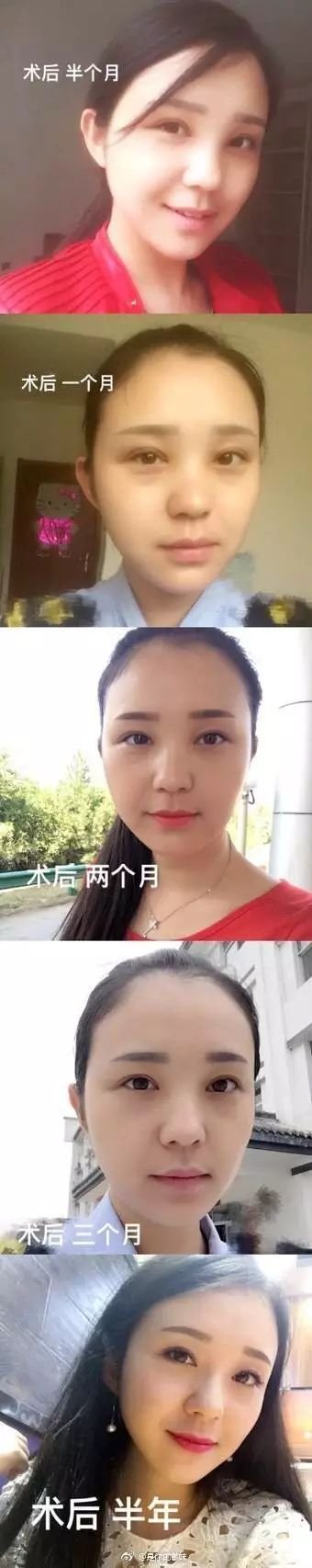 https://img.miyanlife.com/mnt/timg/180411/13154L422-6.jpg